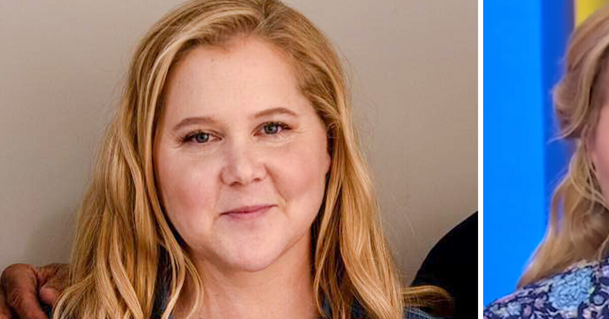 “What Happened to Her Face?” Amy Schumer Leaves Fans Concerned as New Pics Surface “What Happened to Her Face?” Amy Schumer Leaves Fans Concerned as New Pics Surface