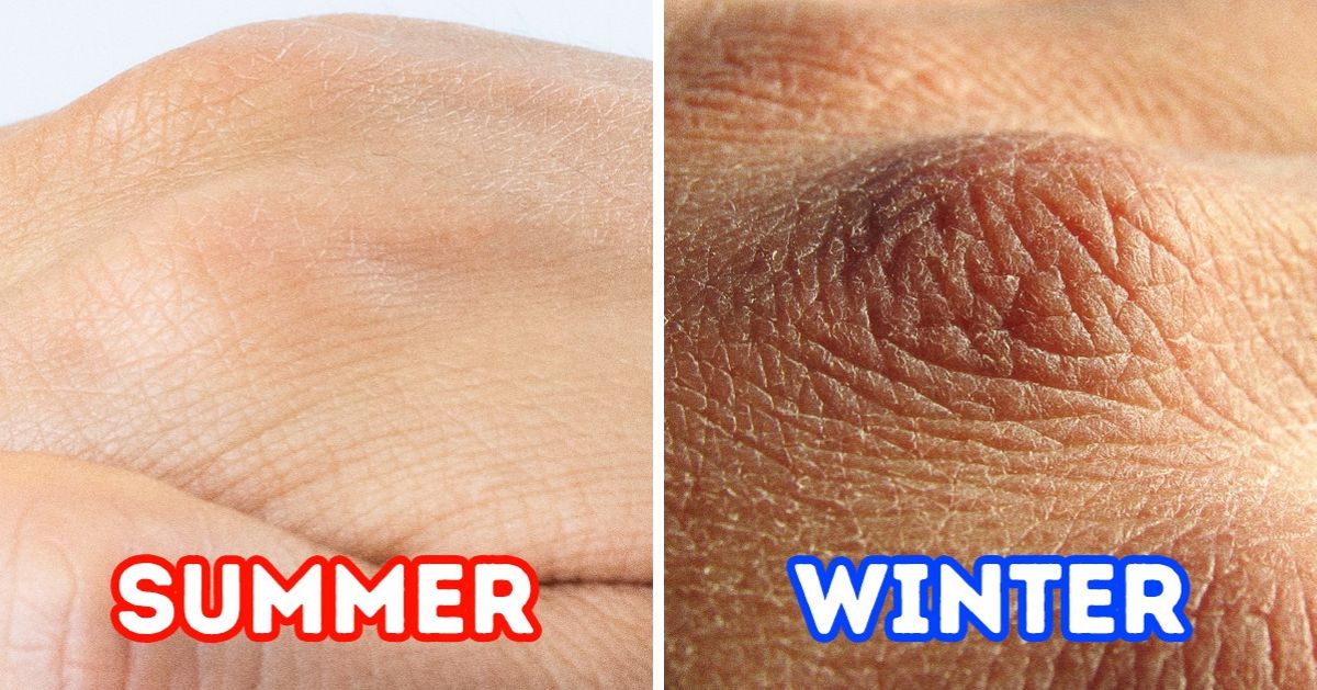 7 Things That Can Happen to Your Body in the Winter 7 Things That Can Happen to Your Body in the Winter
