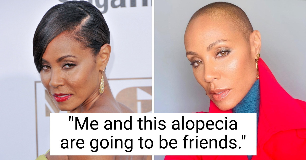 10 Celebrities Revealed Why They Shaved Their Heads, and We Couldn’t Be More Proud of Them