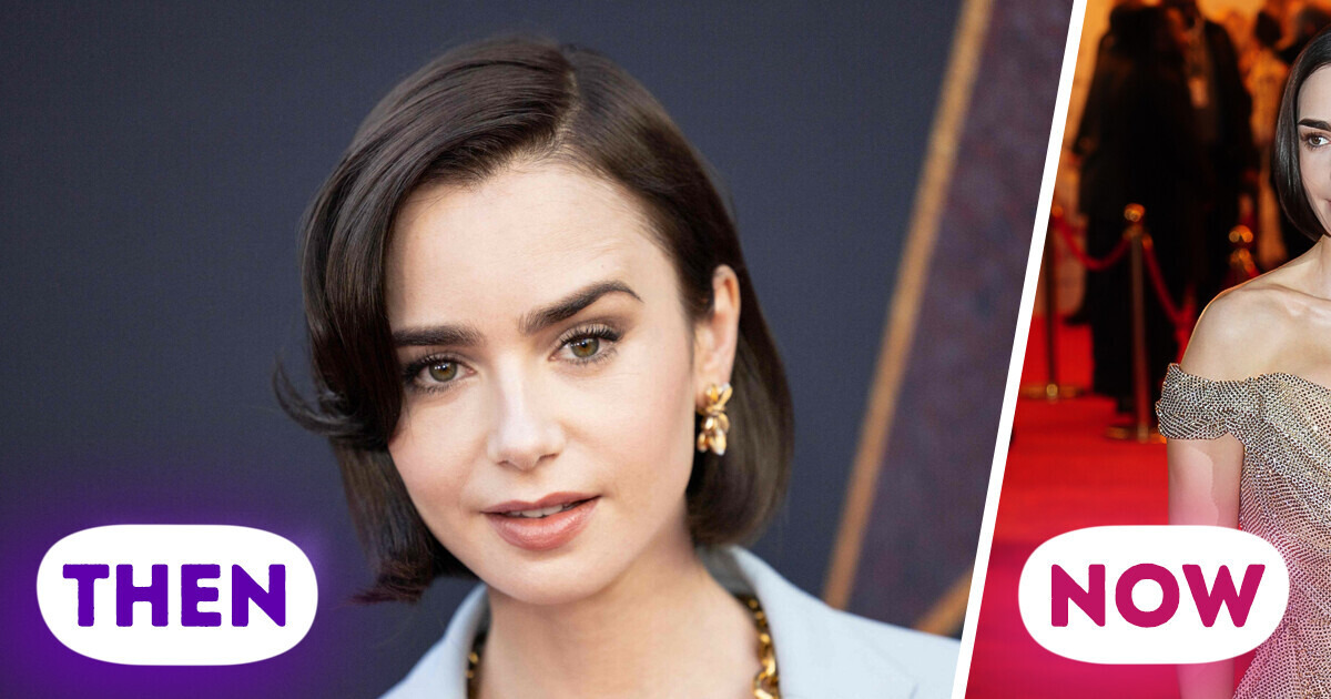 “Why Are the Implants So Bad?” Lily Collins Leaves the Internet Stunned in Recent Appearance