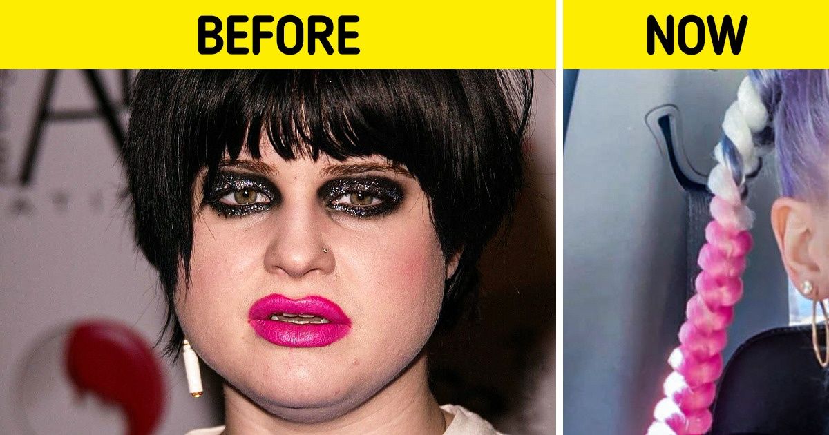 13 Celebrities Who Underwent a Radical Makeover 13 Celebrities Who Underwent a Radical Makeover