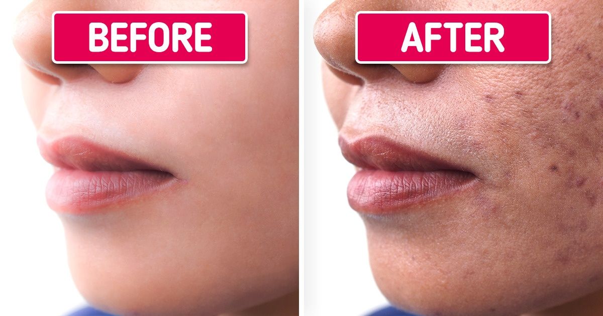 7 Things That May Cause Dark Spots