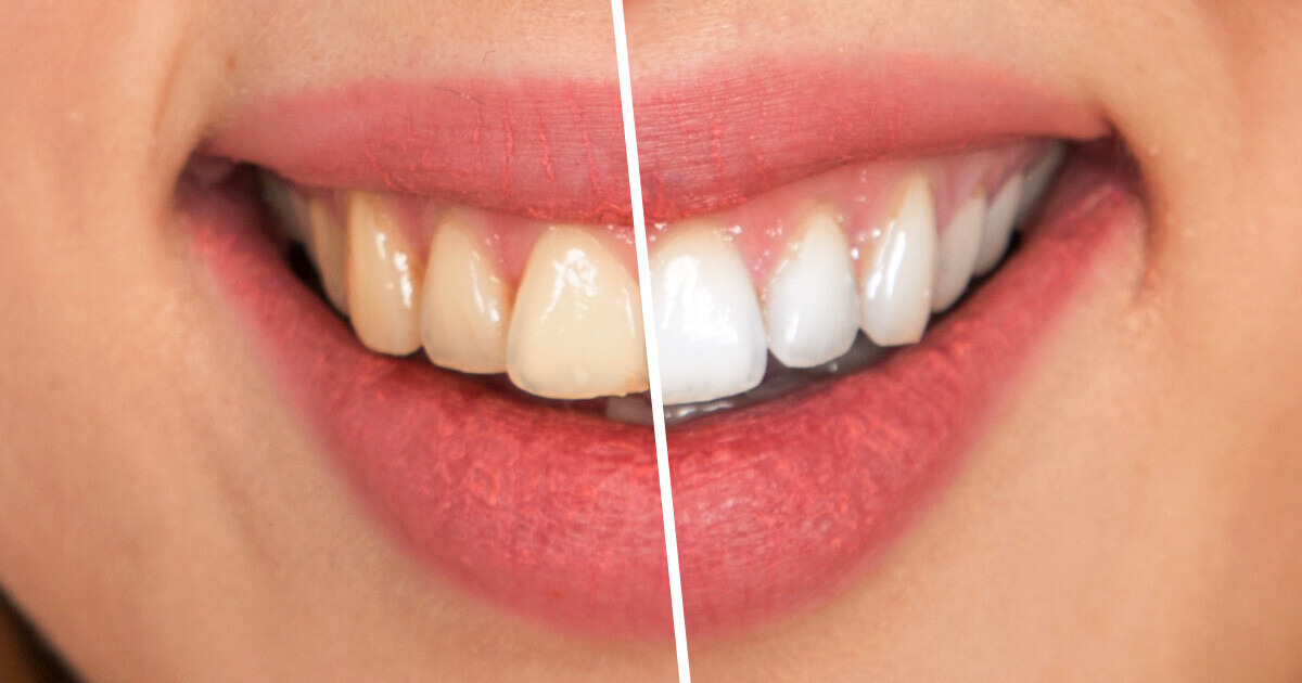10 Simple Rules for Looking Great Without Makeup