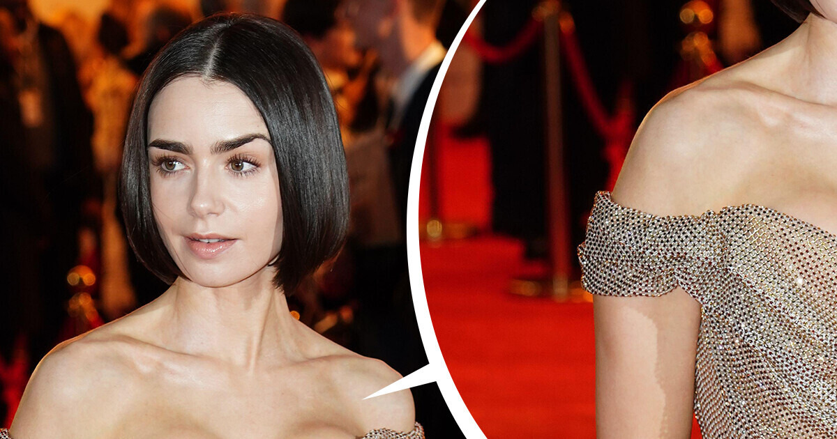 “The Implants Are So Visible,” Lily Collins Debutes New Look and Sparks