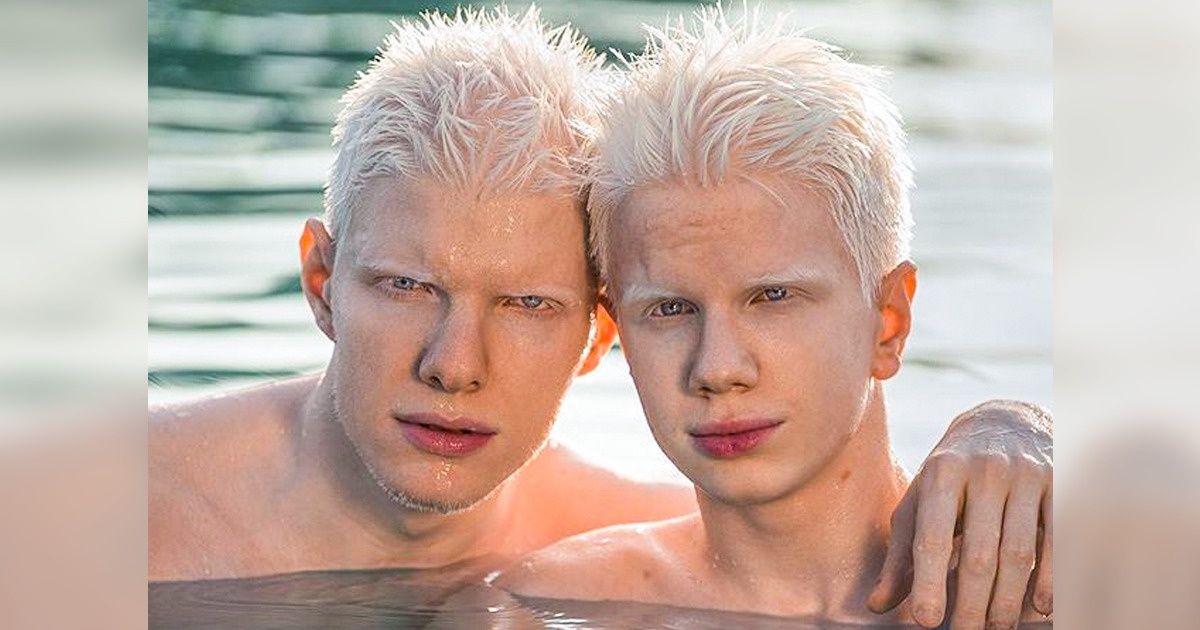 16 People Who Were Endowed With a Magnetic Appearance