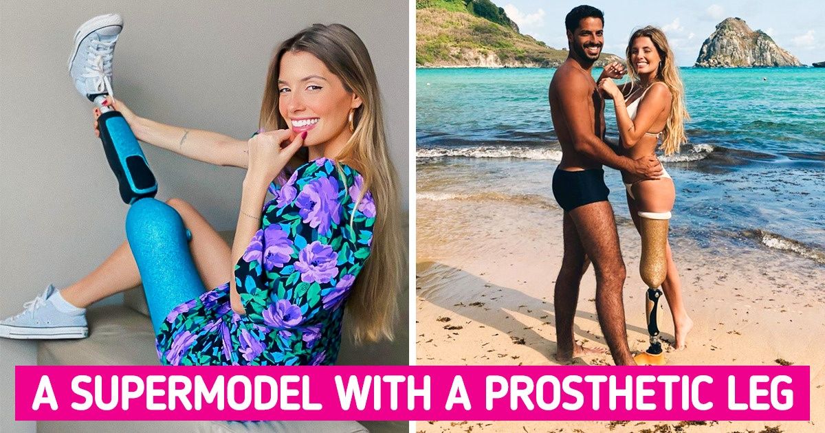 20+ Extraordinary People That Redefined Beauty Standards 20+ Extraordinary People That Redefined Beauty Standards