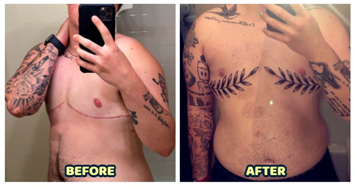 16 People Who Turned Their Scars Into a Powerful Story to Be Told