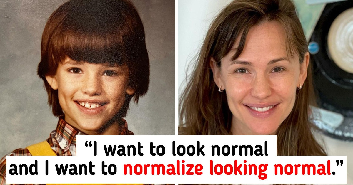 Jennifer Garner, 49, Wants to 'Normalize Looking Normal
