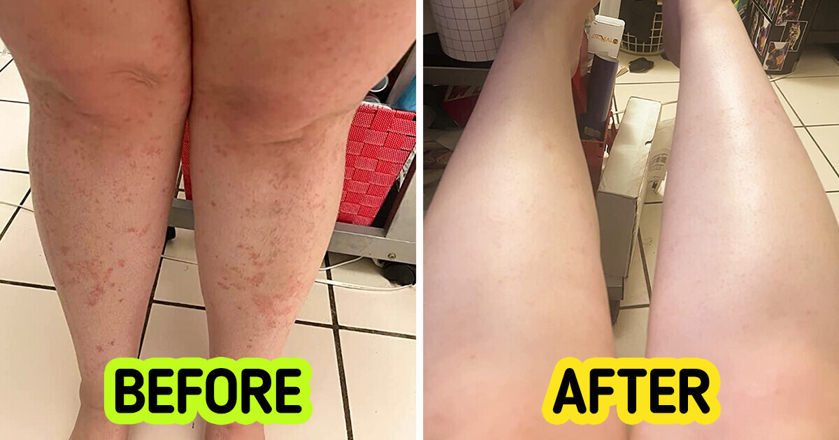 8 Wow-Worthy Beauty Products That Will Make You Shed Happy Tears at the Results (and the Discounts) 8 Wow-Worthy Beauty Products That Will Make You Shed Happy Tears at the Results (and the Discounts)