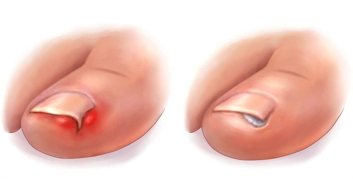 8 Side Effects of Antibiotics Doctors Rarely Tell Us About 8 Side Effects of Antibiotics Doctors Rarely Tell Us About