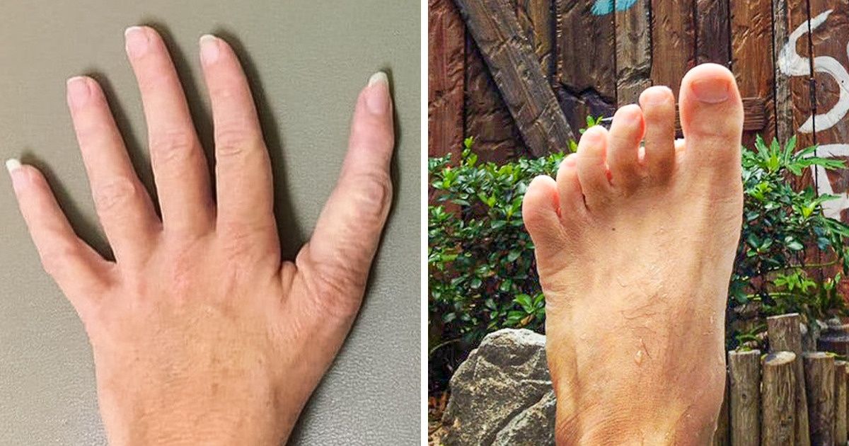 14 People Who Have an Easter Egg From Nature Right on Their Bodies 14 People Who Have an Easter Egg From Nature Right on Their Bodies