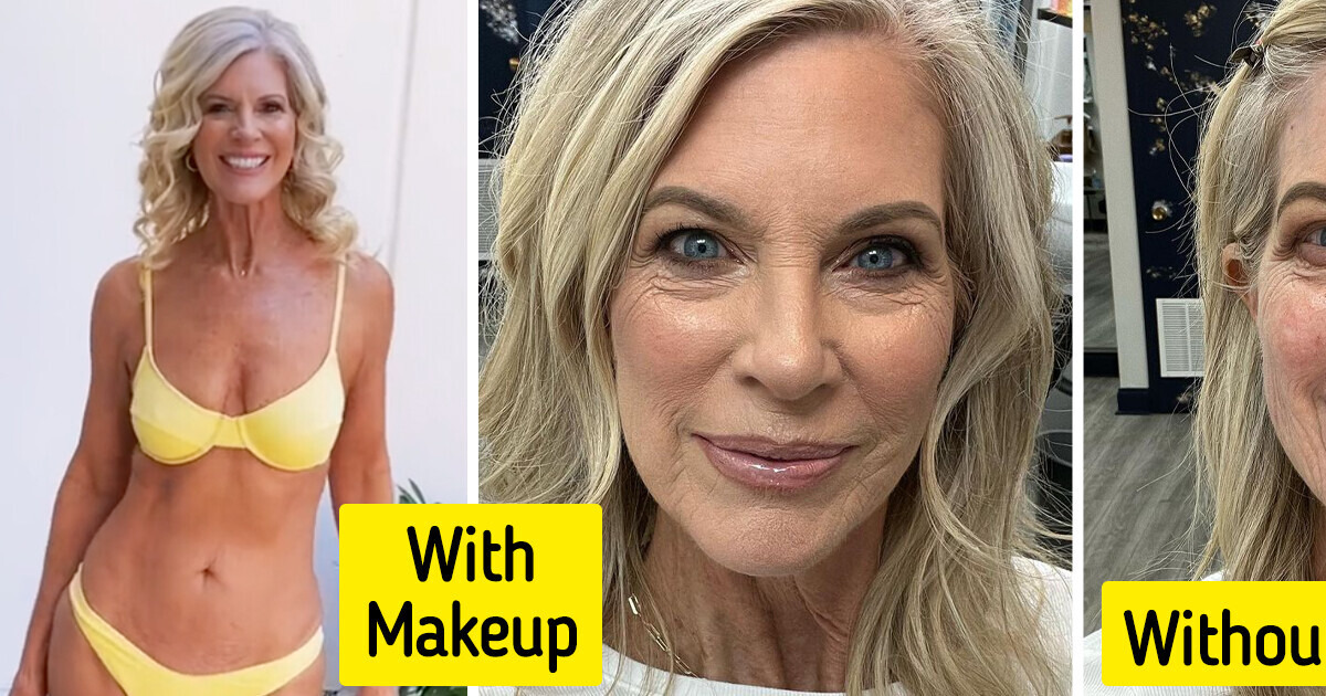 A Woman, 64, Warns People to Use Sunscreen and Stuns With Her Natural Body Transformation