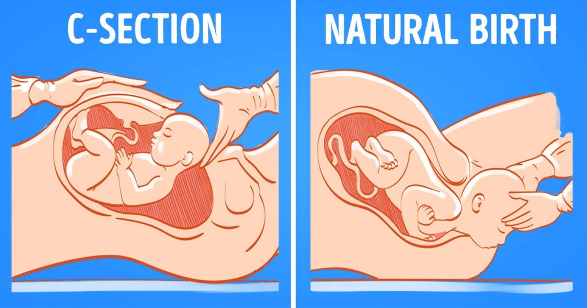 We Are Debunking 11 Pregnancy Myths to Help All Mothers-to