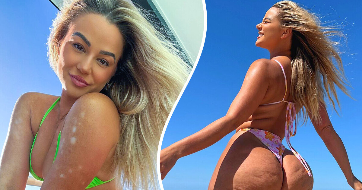 Body Positive Influencer Goes Viral by Revealing Unfiltered Beauty Body Positive Influencer Goes Viral by Revealing Unfiltered Beauty