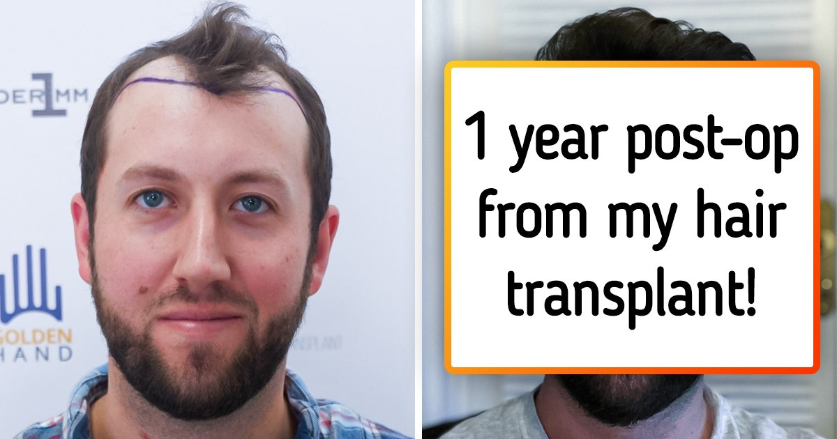 18 People Who Couldn’t Be Prouder of Their Hair Makeovers