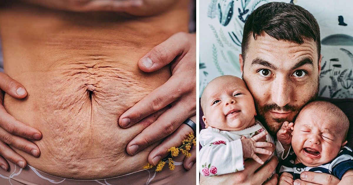 A Husband Thanks His Wife and Pens a Letter About Her Belly After Childbirth A Husband Thanks His Wife and Pens a Letter About Her Belly After Childbirth