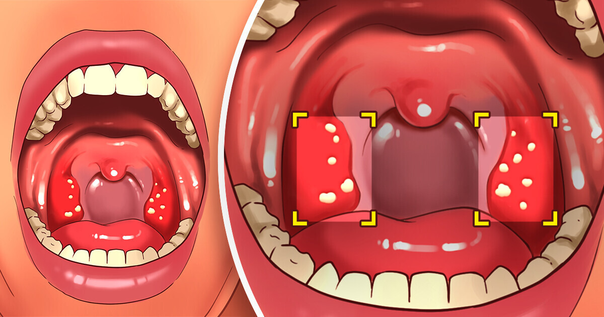 9 Simple Ways to Keep Your Teeth Healthy