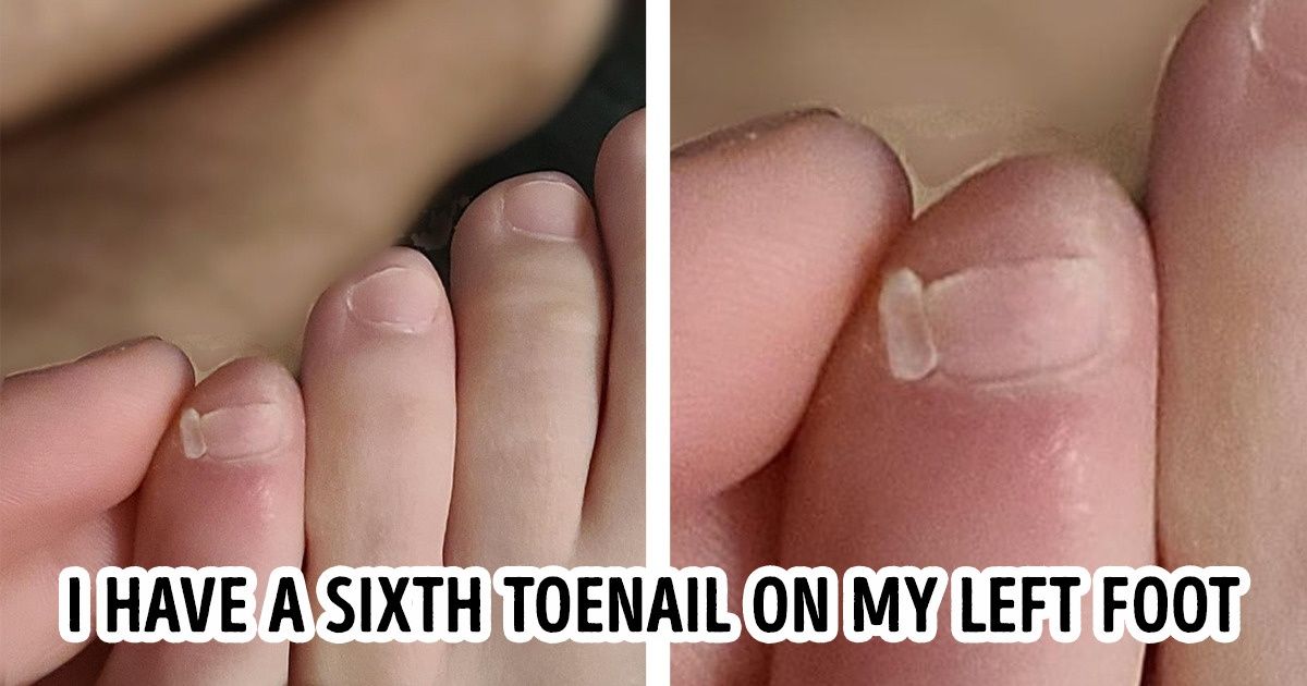 15 People Who Have Received an Extra Gift From Mother Nature