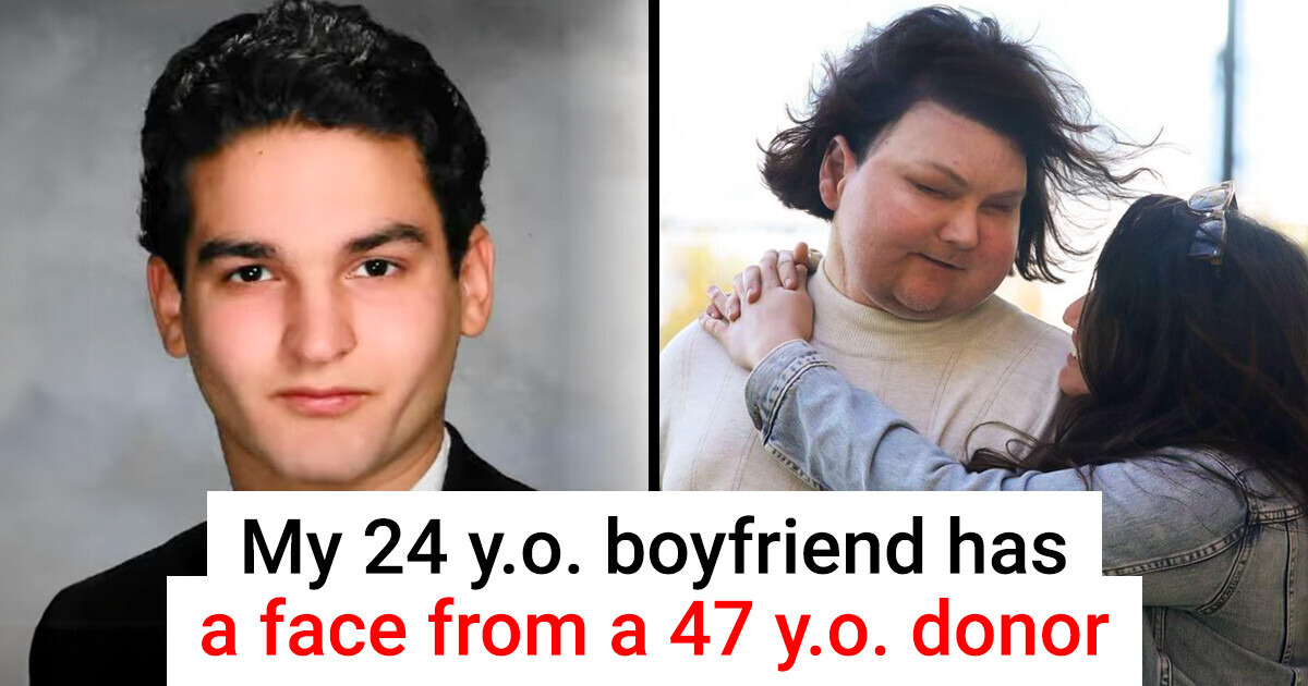 A Woman Shares Her Love Story With a Man Who Suffered Burns on 80% of His Body A Woman Shares Her Love Story With a Man Who Suffered Burns on 80% of His Body