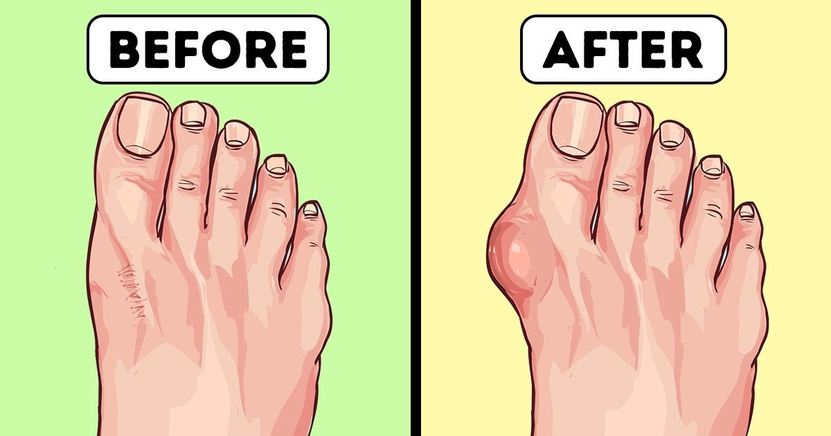 10 Reasons to Ditch Your Flip-Flops Right Now for the Sake of Your Health 10 Reasons to Ditch Your Flip-Flops Right Now for the Sake of Your Health