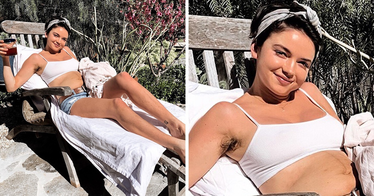 13 Celebrities Who Remind Us Beauty Doesn’t Equal Perfection