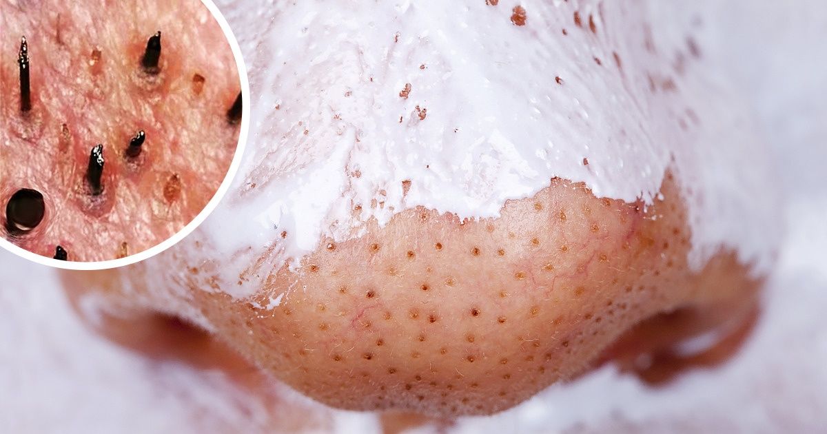 11 Skin-Transforming Masks You Can Make at Home 11 Skin-Transforming Masks You Can Make at Home