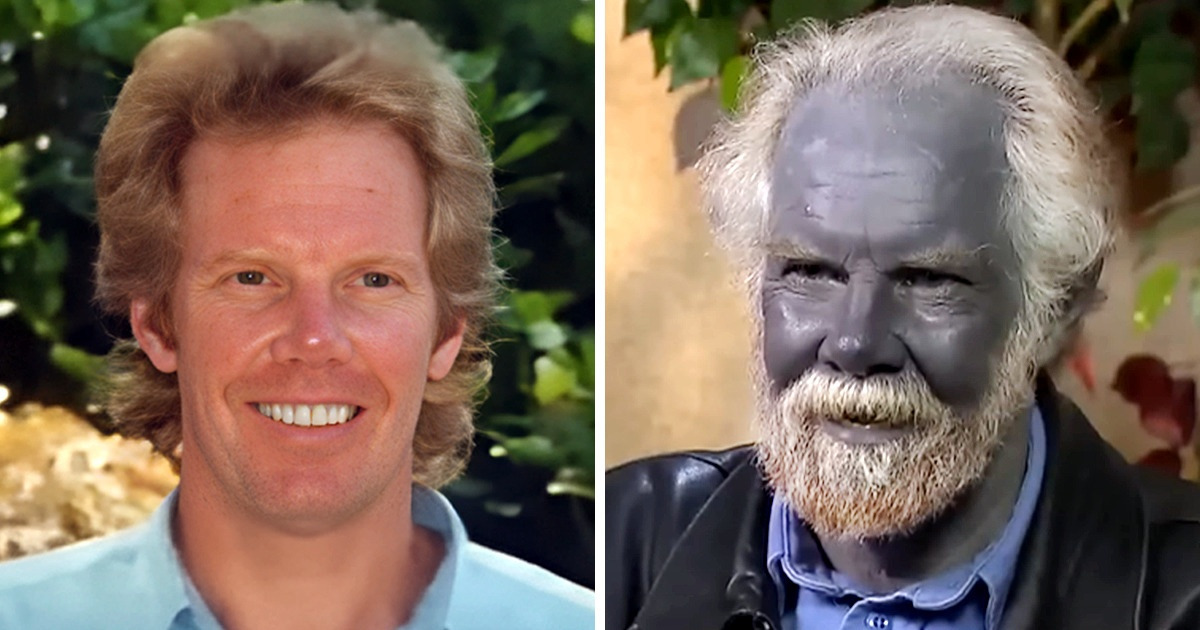 This is Paul Karason, the man who turned blue in 2007. He passed away,  yesterday at age 62. : r/pics