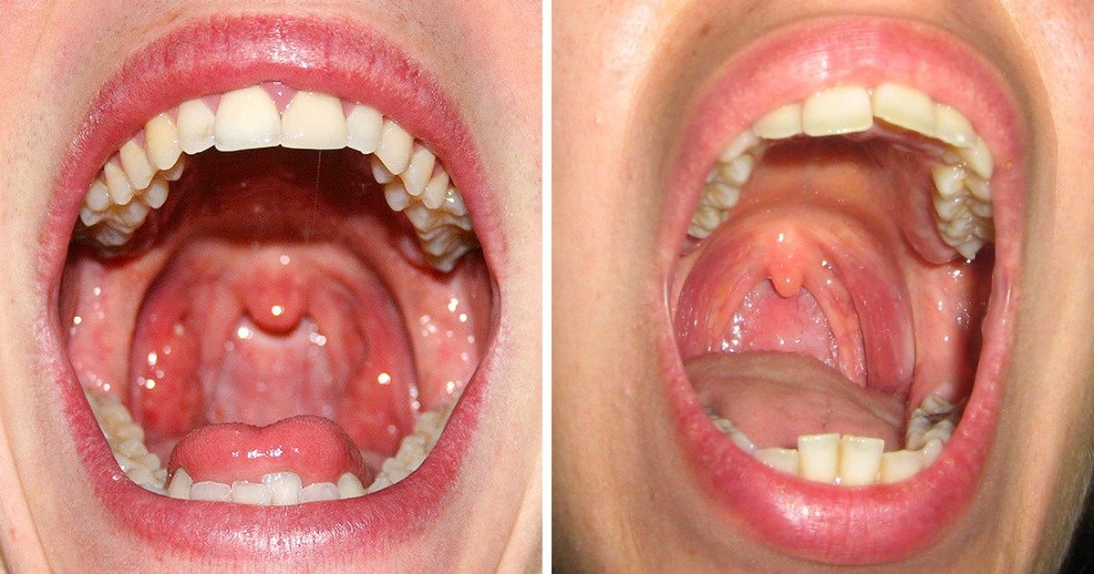 if-you-suffer-from-a-dry-mouth-here-are-7-ways-to-help-you