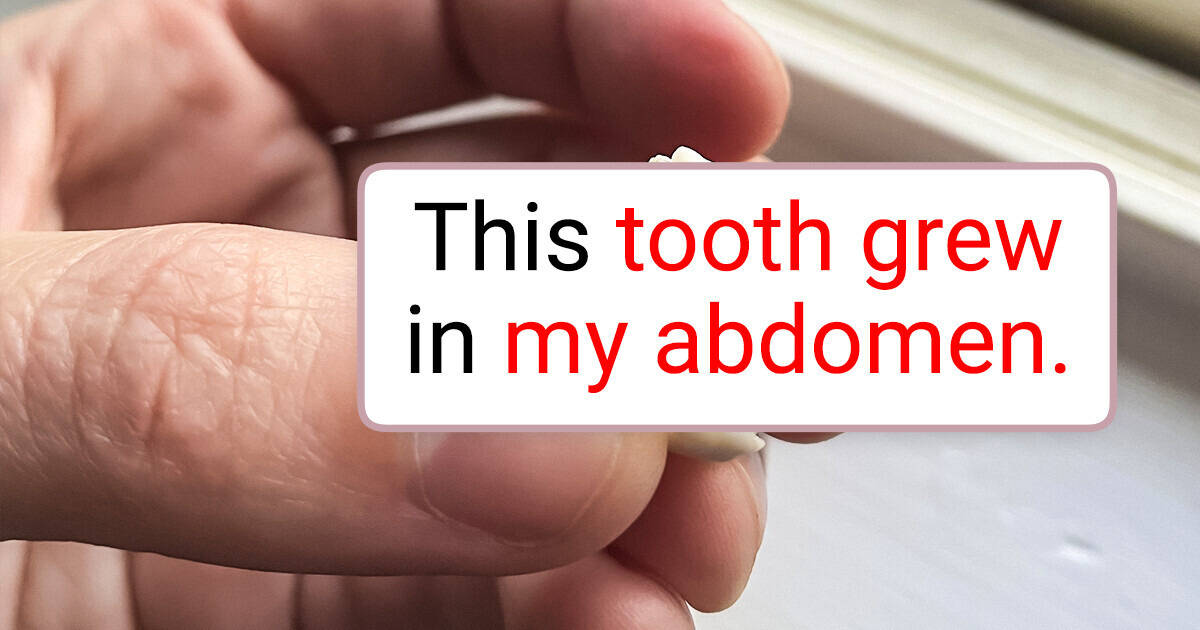 10+ People Reveal Their Most Curious Discoveries