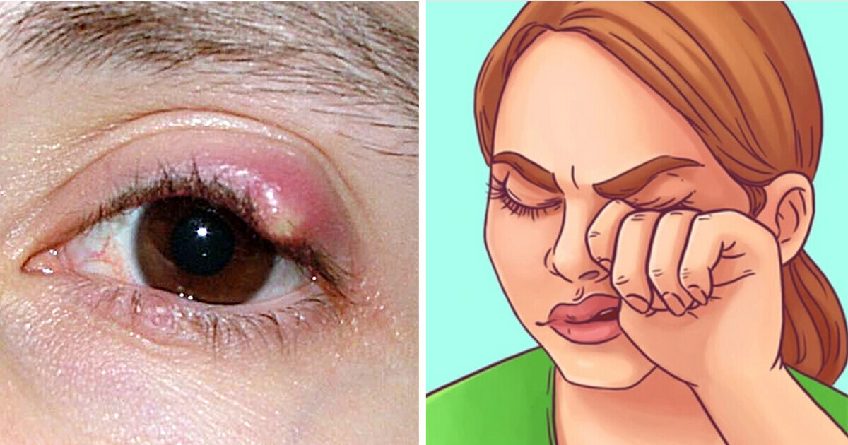 10 Health Signs Your Eyes Might Reveal About Your Body 10 Health Signs Your Eyes Might Reveal About Your Body