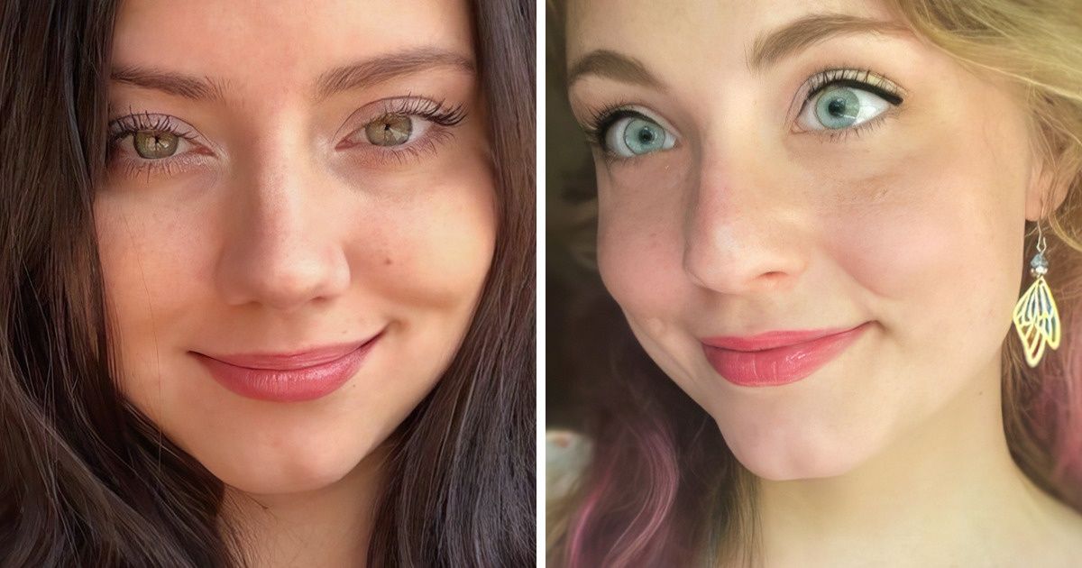 20 People Who Were Gifted With Something Special by Nature