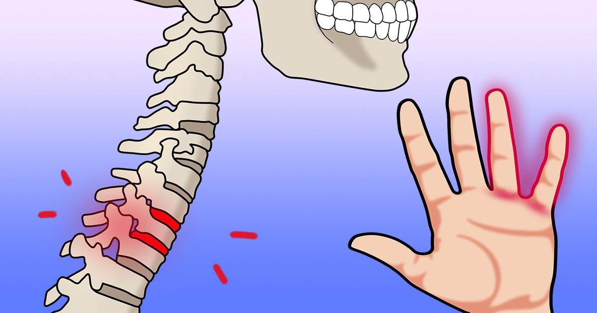 10 Causes for Hand Numbness That Scream You Need to See a Doctor 10 Causes for Hand Numbness That Scream You Need to See a Doctor