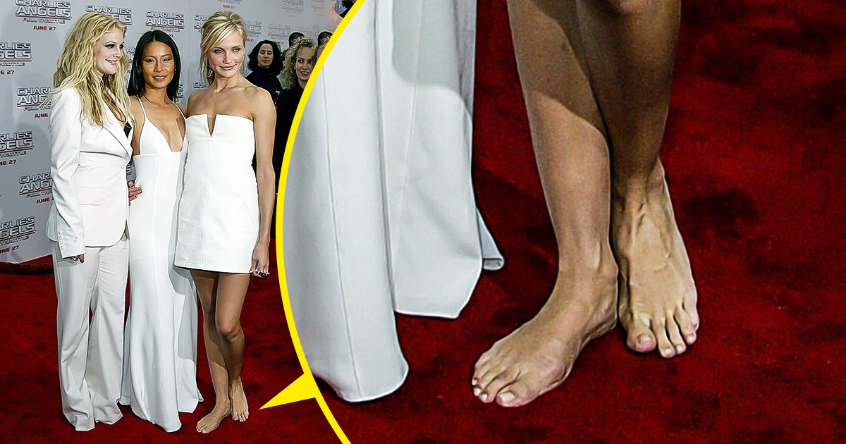 8 Celebrities Mishaps That Probably Will Stick With Them Forever