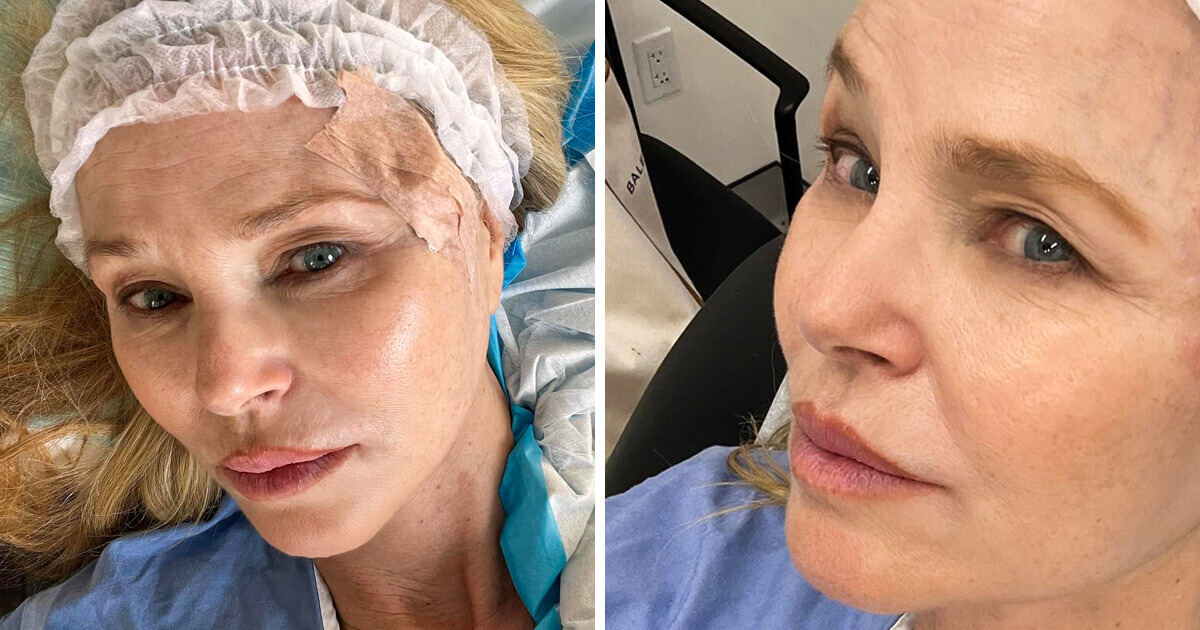 Christie Brinkley Diagnosed With Heartbreaking Condition at 70, Shares Tragic Update Christie Brinkley Diagnosed With Heartbreaking Condition at 70, Shares Tragic Update