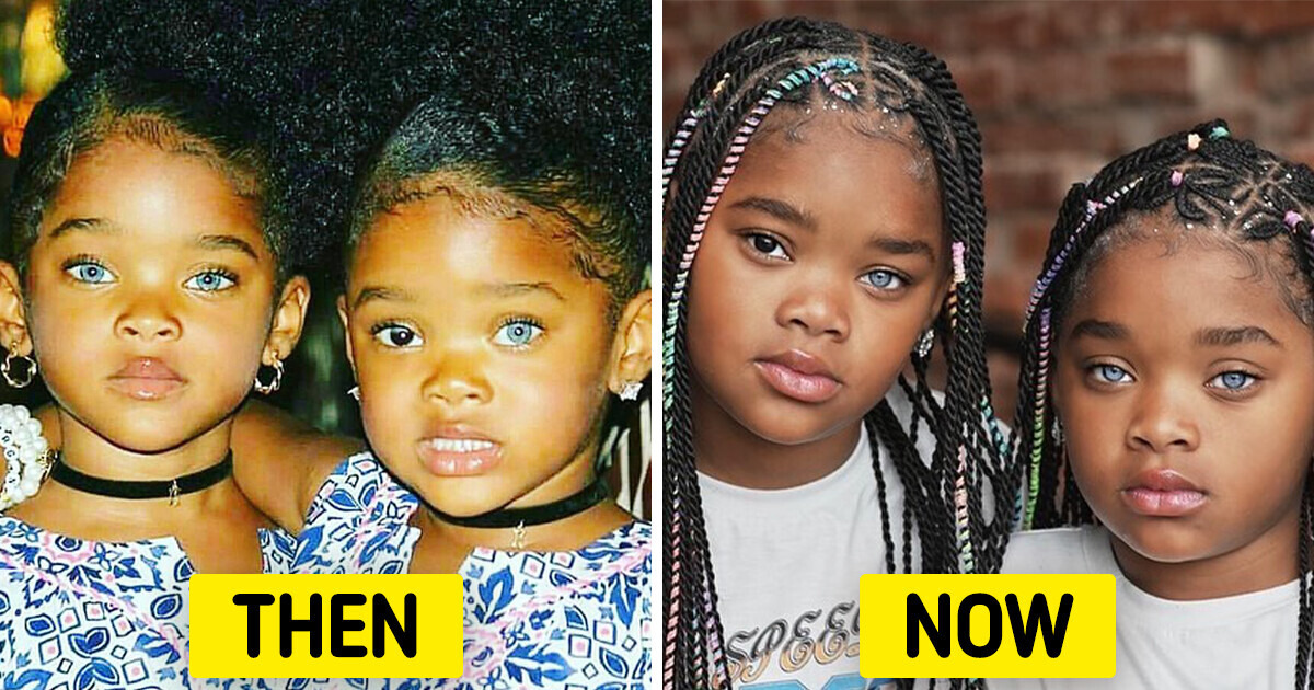 23 People With Exceptional Beauty That Captivated Us