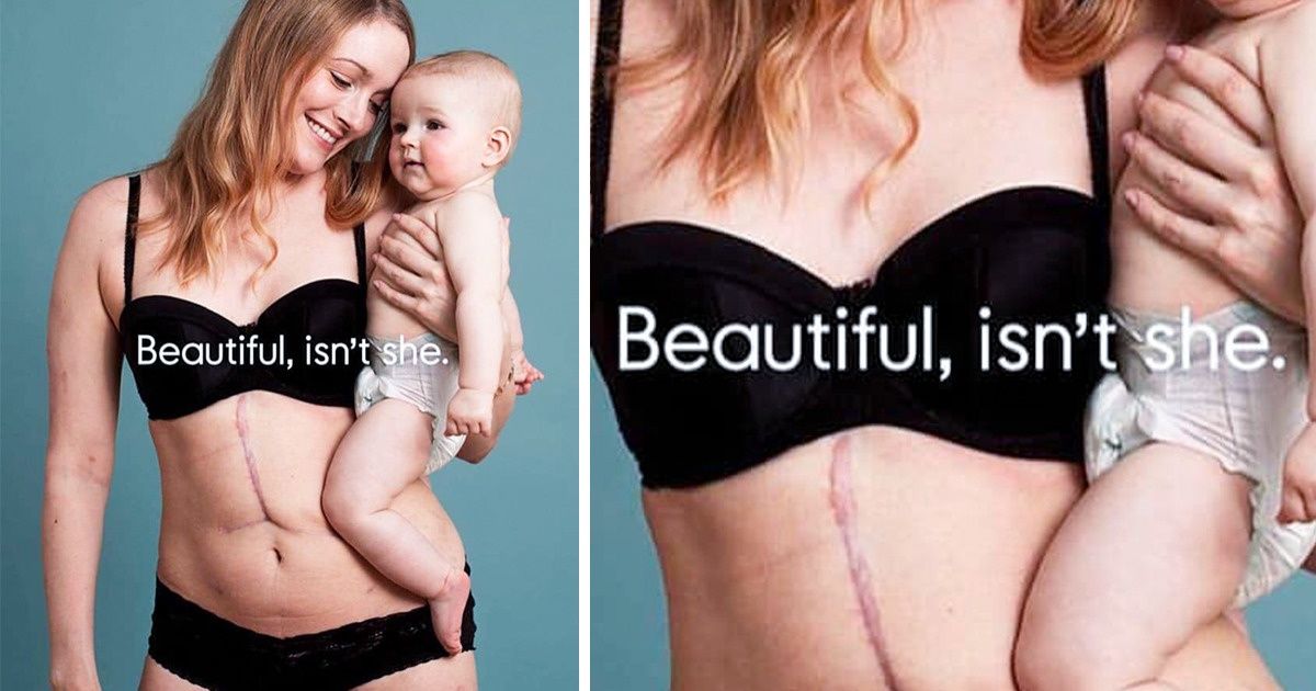 20 Fresh Social Campaigns That Are a True Vaccine Against Indifference 20 Fresh Social Campaigns That Are a True Vaccine Against Indifference
