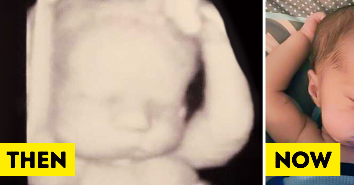 King of Chill: A Baby Sleeps in Arms Up Position Just Like in the Ultrasound King of Chill: A Baby Sleeps in Arms Up Position Just Like in the Ultrasound