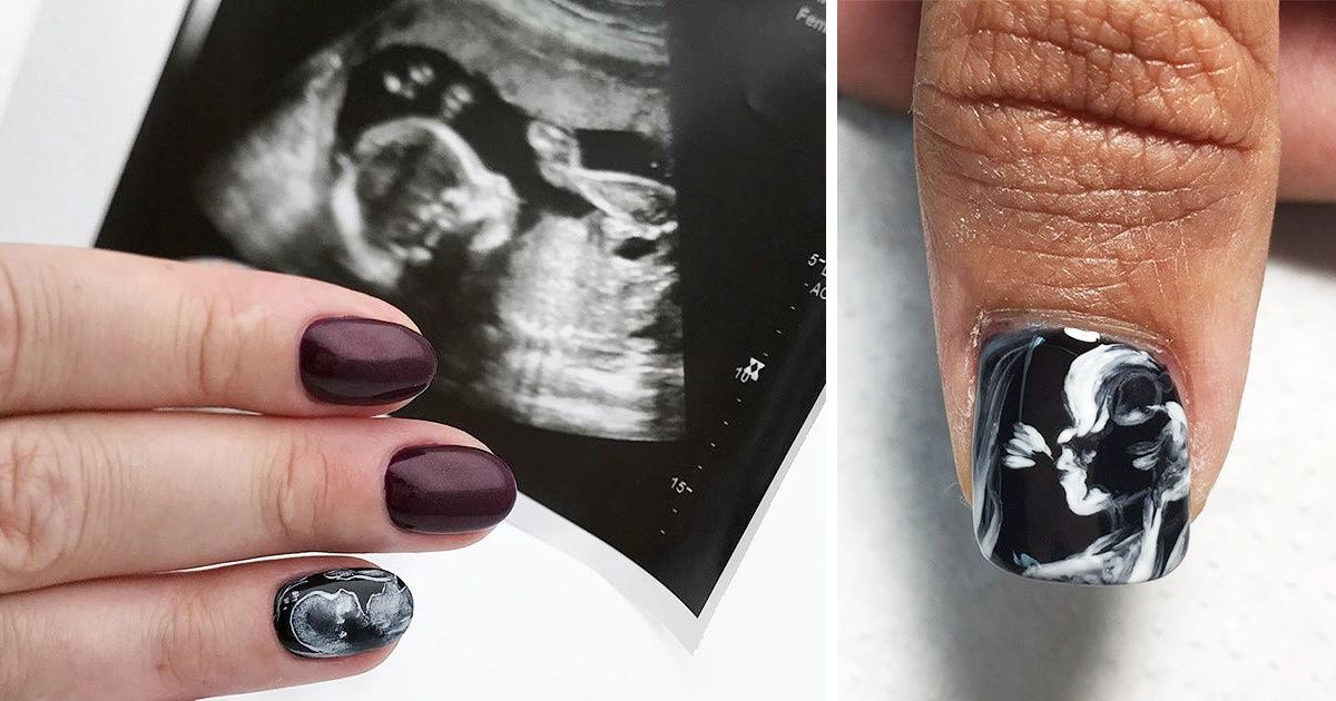 Pregnant Women Are Using Their Sonograms to Create Adorable Nail Art