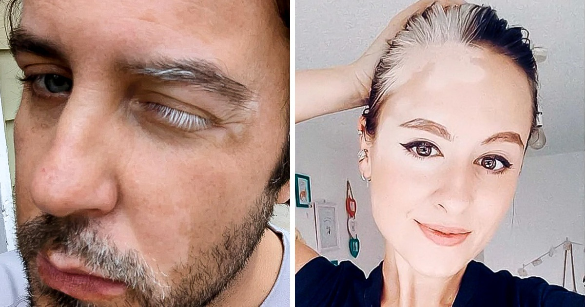 15+ People and Animals With Fascinating Features That Make Us Admire This World Even More 15+ People and Animals With Fascinating Features That Make Us Admire This World Even More