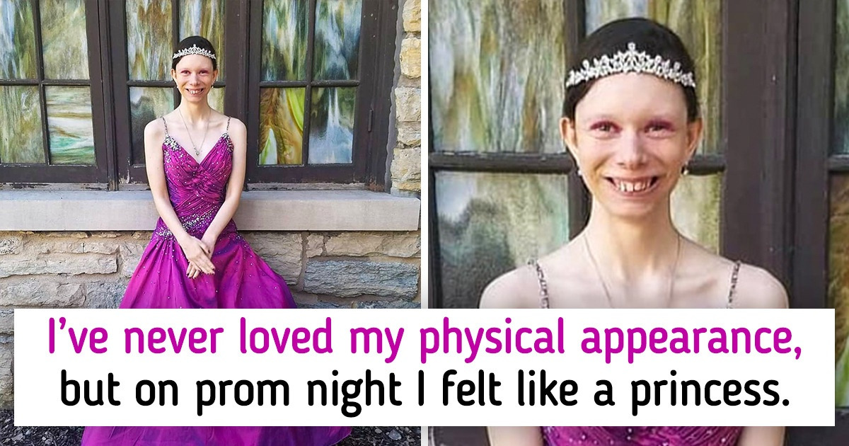 12 Brave People Who Decided to Fight Their Insecurities