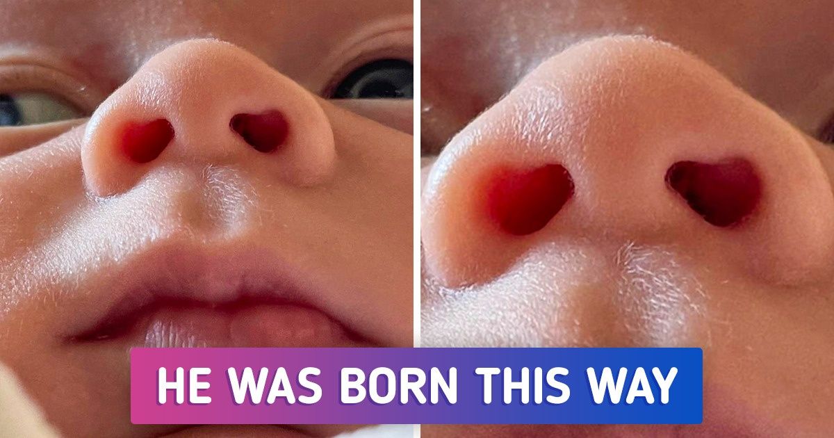 18 Times Nature Got Creative and Awarded People With Unique Traits 18 Times Nature Got Creative and Awarded People With Unique Traits