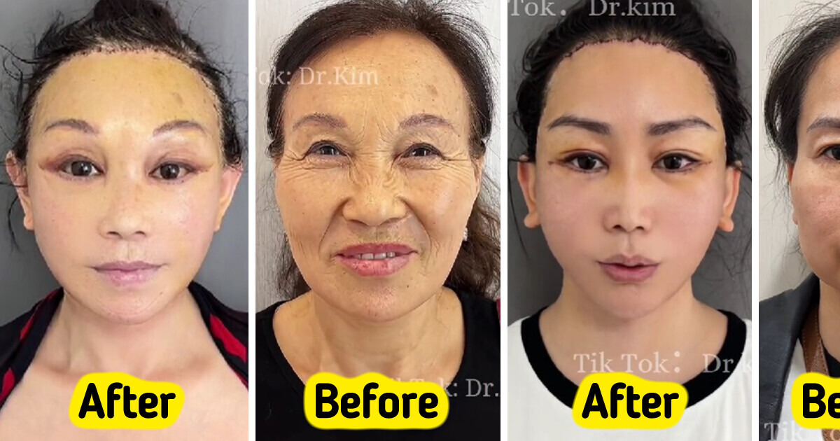 A Plastic Surgeon Goes Viral for His Transformation Videos A Plastic Surgeon Goes Viral for His Transformation Videos