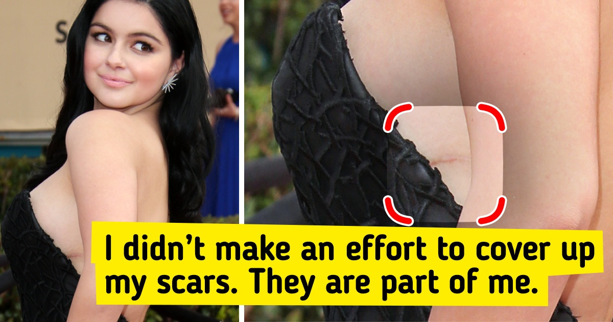 10 Stars Who Show Their “Imperfect” Pics and Inspire Us to Be Proud of Our Flaws