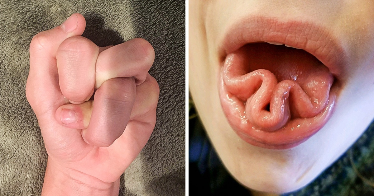 19 Photos That Prove the Human Body Is a Wonderland Indeed