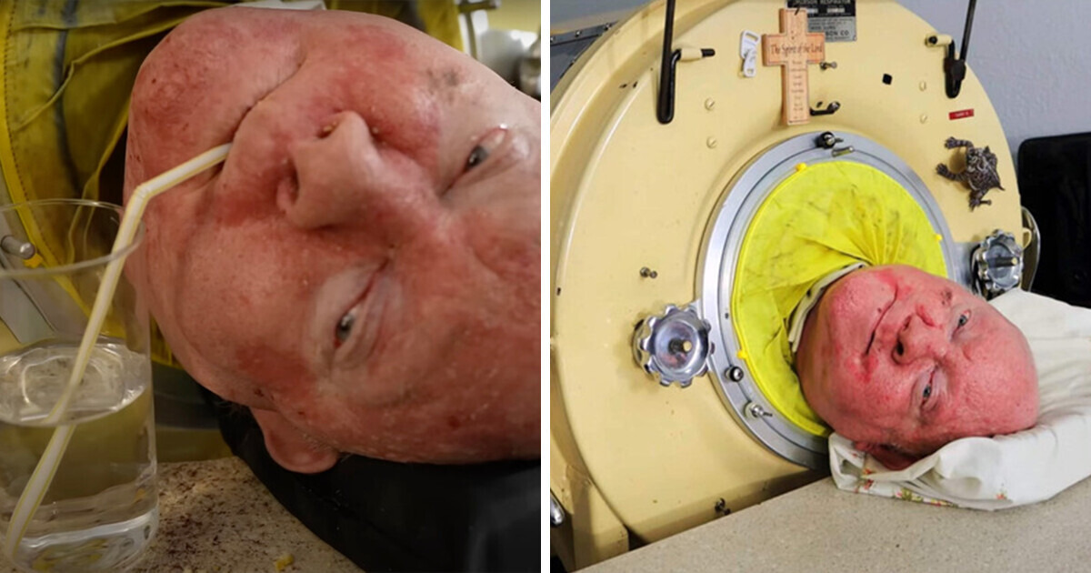 How a Man Living in an Iron Lung for 70 Years Became a Lawyer and Why He Was Forbidden to Marry