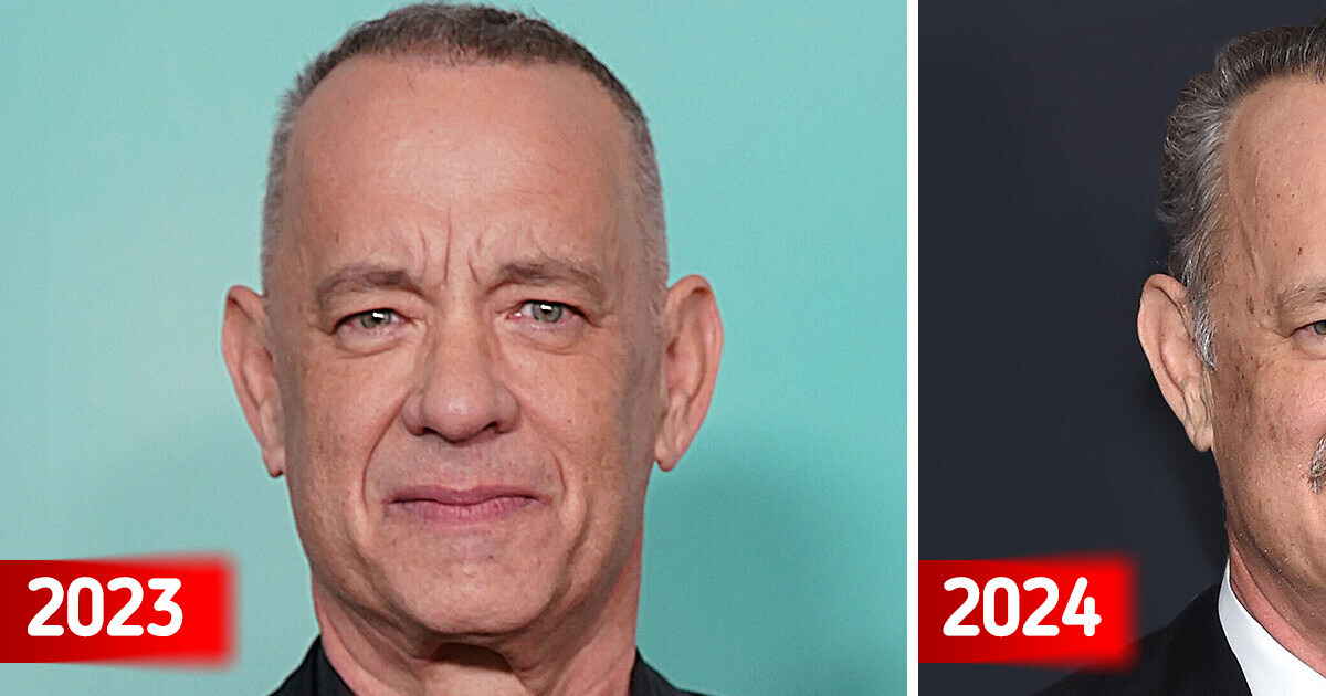 ''is He Ok?'' Tom Hanks Shocks Fans In New Look — Fans Are Worried 