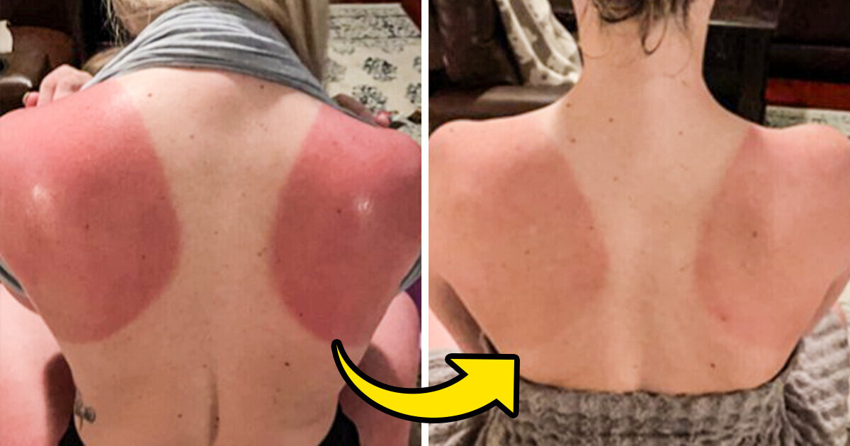 beauty nightmares no more: 15 products are here to save you beauty nightmares no more: 15 products are here to save you