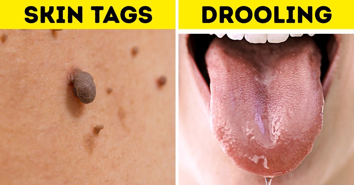 8 Unexpected Signs of Pregnancy You Might Not Even Know About
