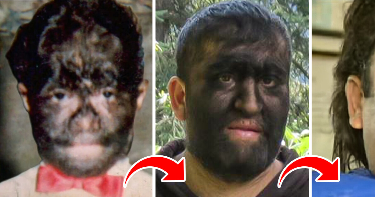 “People Got Angry,” Wolf Man Was Forced to Look “Normal” As He Struggles to Find Job Beyond Circus “People Got Angry,” Wolf Man Was Forced to Look “Normal” As He Struggles to Find Job Beyond Circus