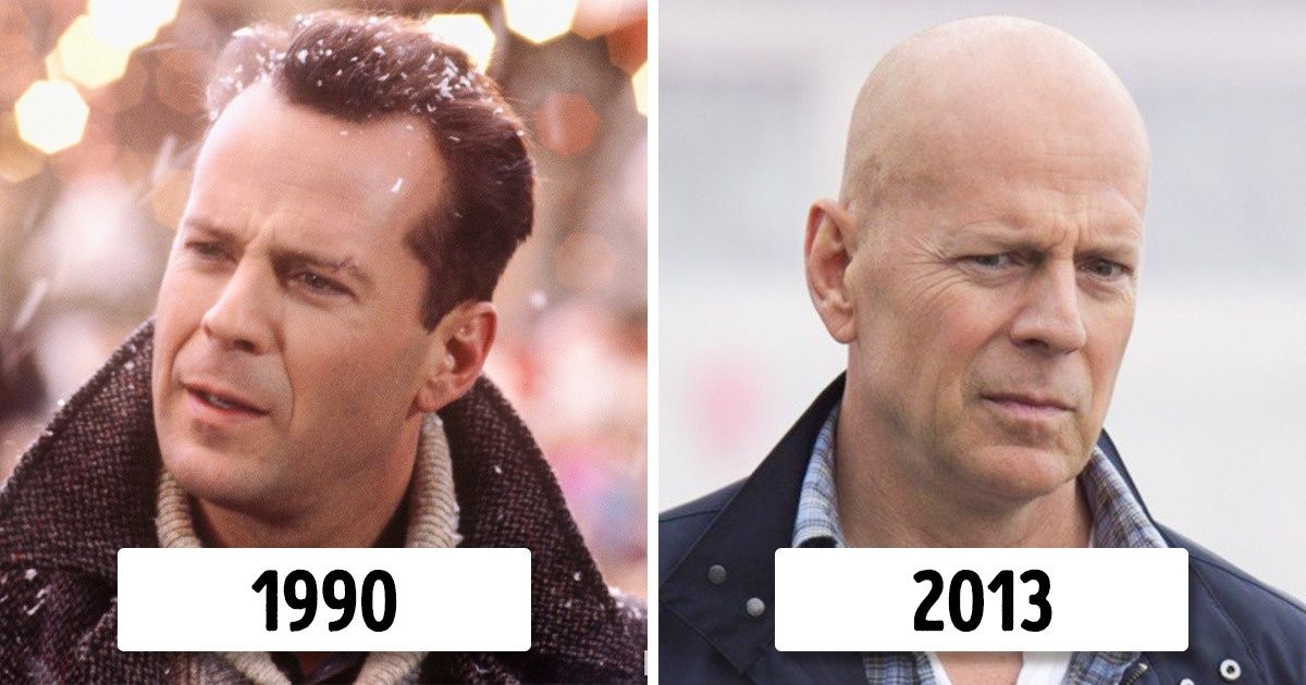 Guys Who Work a Lot Are More Likely to End Up Bald, According to a Recent Study Guys Who Work a Lot Are More Likely to End Up Bald, According to a Recent Study